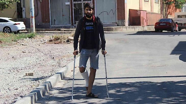 Ağabeyi, kardeşi ve yeğenleri tarafından darp edilmişti, bu sefer de ayağından vuruldu