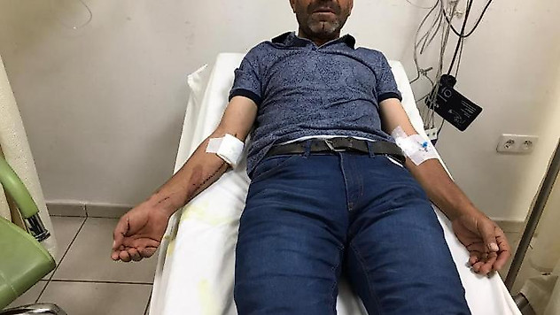 Ayı çobana saldırdı