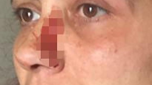 Büyükçekmece'de sitede kadına darp iddiası
