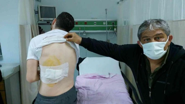 Ankara'dan bayram için geldiği Samsun'da sokak köpeğinin saldırısına uğradı